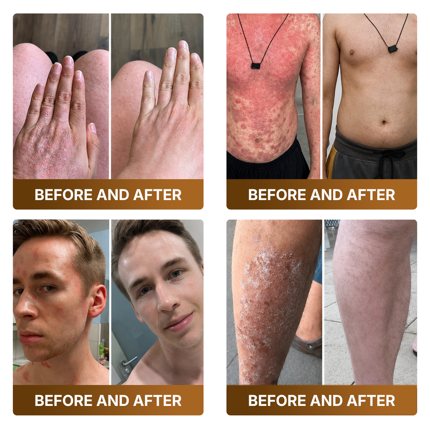 【Made and Shipped from US】🚑 DOCTIA® Botox & Bee Venom Advanced Recovery Cream—For Wrinkles, Sagging Skin, Skin Tags & Rough Bumps⚡