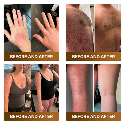 【Made and Shipped from US】🚑 DOCTIA® Botox & Bee Venom Advanced Recovery Cream—For Wrinkles, Sagging Skin, Skin Tags & Rough Bumps⚡