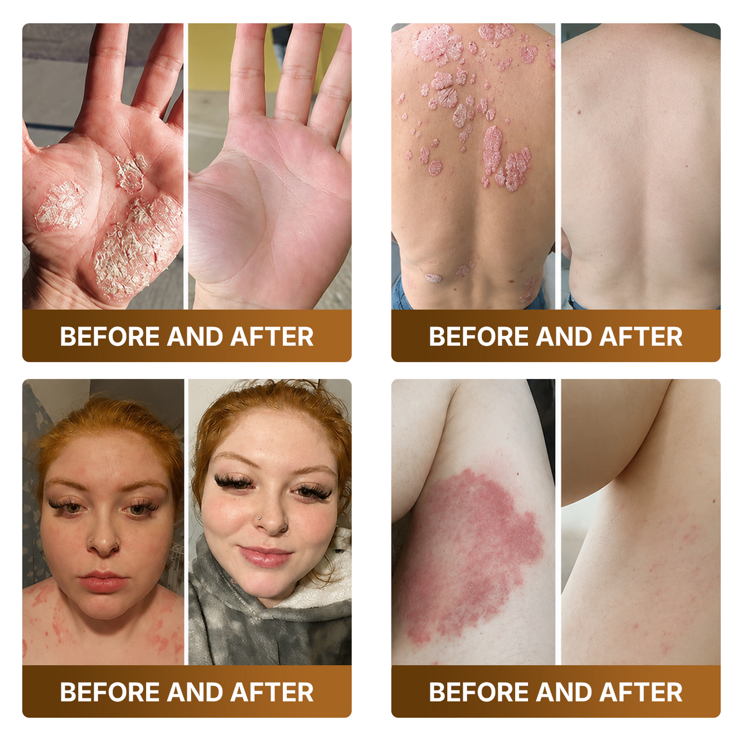 【Made and Shipped from US】🚑 DOCTIA® Botox & Bee Venom Advanced Recovery Cream—For Wrinkles, Sagging Skin, Skin Tags & Rough Bumps⚡