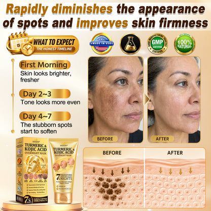 𝑶𝒇𝒇𝒊𝒄𝒊𝒂𝒍 𝑺𝒕𝒐𝒓𝒆 | 𝐍𝐞𝐰! ✨ 𝐇𝐢𝐬𝐤𝐢𝐧® 𝐓𝐮𝐫𝐦𝐞𝐫𝐢𝐜 × 𝐊𝐨𝐣𝐢𝐜 𝐀𝐜𝐢𝐝 𝐎𝐯𝐞𝐫𝐧𝐢𝐠𝐡𝐭 𝐏𝐞𝐞𝐥-𝐎𝐟𝐟 𝐌𝐚𝐬𝐤 — 𝐅𝐚𝐝𝐞 𝐒𝐭𝐮𝐛𝐛𝐨𝐫𝐧 𝐃𝐚𝐫𝐤 𝐒𝐩𝐨𝐭𝐬 & 𝐒𝐦𝐨𝐨𝐭𝐡 𝐕𝐢𝐬𝐢𝐛𝐥𝐞 𝐖𝐫𝐢𝐧𝐤𝐥𝐞𝐬 𝐖𝐡𝐢𝐥𝐞 𝐘𝐨𝐮 𝐒𝐥𝐞𝐞𝐩 🌙✨ 𝐓𝐮𝐫𝐦𝐞𝐫𝐢𝐜 × 𝐊𝐨𝐣𝐢𝐜 𝐀𝐜𝐢𝐝 × 𝐏𝐞𝐩𝐭𝐢𝐝𝐞𝐬 ✅ 𝐎𝐧𝐞 𝐒𝐭𝐞𝐩 𝐚 𝐍𝐢𝐠𝐡𝐭 · 𝐕𝐢𝐬𝐢𝐛𝐥𝐞 𝐂𝐡𝐚𝐧𝐠𝐞𝐬 𝐢𝐧 𝟕 𝐍𝐢𝐠𝐡𝐭𝐬 💯