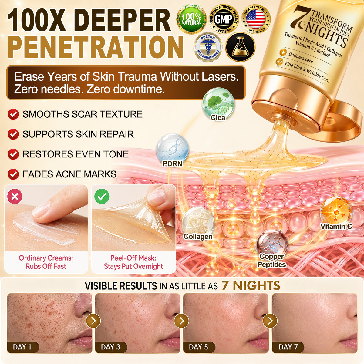 𝑶𝒇𝒇𝒊𝒄𝒊𝒂𝒍 𝑺𝒕𝒐𝒓𝒆 | 𝐍𝐞𝐰! ✨ 𝐇𝐢𝐬𝐤𝐢𝐧® 𝐓𝐮𝐫𝐦𝐞𝐫𝐢𝐜 × 𝐊𝐨𝐣𝐢𝐜 𝐀𝐜𝐢𝐝 𝐎𝐯𝐞𝐫𝐧𝐢𝐠𝐡𝐭 𝐏𝐞𝐞𝐥-𝐎𝐟𝐟 𝐌𝐚𝐬𝐤 — 𝐅𝐚𝐝𝐞 𝐒𝐭𝐮𝐛𝐛𝐨𝐫𝐧 𝐃𝐚𝐫𝐤 𝐒𝐩𝐨𝐭𝐬 & 𝐒𝐦𝐨𝐨𝐭𝐡 𝐕𝐢𝐬𝐢𝐛𝐥𝐞 𝐖𝐫𝐢𝐧𝐤𝐥𝐞𝐬 𝐖𝐡𝐢𝐥𝐞 𝐘𝐨𝐮 𝐒𝐥𝐞𝐞𝐩 🌙✨ 𝐓𝐮𝐫𝐦𝐞𝐫𝐢𝐜 × 𝐊𝐨𝐣𝐢𝐜 𝐀𝐜𝐢𝐝 × 𝐏𝐞𝐩𝐭𝐢𝐝𝐞𝐬 ✅ 𝐎𝐧𝐞 𝐒𝐭𝐞𝐩 𝐚 𝐍𝐢𝐠𝐡𝐭 · 𝐕𝐢𝐬𝐢𝐛𝐥𝐞 𝐂𝐡𝐚𝐧𝐠𝐞𝐬 𝐢𝐧 𝟕 𝐍𝐢𝐠𝐡𝐭𝐬 💯