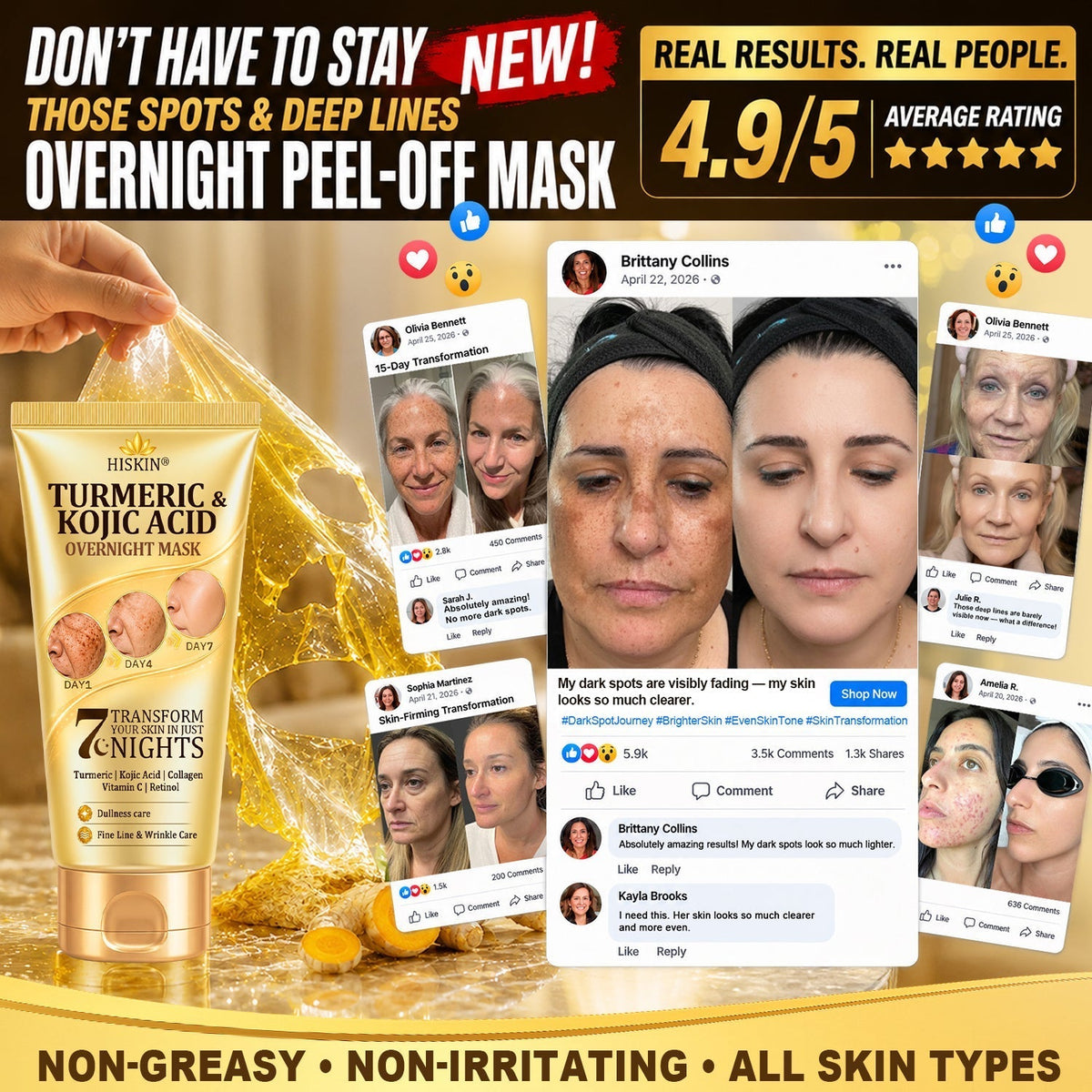 𝑶𝒇𝒇𝒊𝒄𝒊𝒂𝒍 𝑺𝒕𝒐𝒓𝒆 | 𝐍𝐞𝐰! ✨ 𝐇𝐢𝐬𝐤𝐢𝐧® 𝐓𝐮𝐫𝐦𝐞𝐫𝐢𝐜 × 𝐊𝐨𝐣𝐢𝐜 𝐀𝐜𝐢𝐝 𝐎𝐯𝐞𝐫𝐧𝐢𝐠𝐡𝐭 𝐏𝐞𝐞𝐥-𝐎𝐟𝐟 𝐌𝐚𝐬𝐤 — 𝐅𝐚𝐝𝐞 𝐒𝐭𝐮𝐛𝐛𝐨𝐫𝐧 𝐃𝐚𝐫𝐤 𝐒𝐩𝐨𝐭𝐬 & 𝐒𝐦𝐨𝐨𝐭𝐡 𝐕𝐢𝐬𝐢𝐛𝐥𝐞 𝐖𝐫𝐢𝐧𝐤𝐥𝐞𝐬 𝐖𝐡𝐢𝐥𝐞 𝐘𝐨𝐮 𝐒𝐥𝐞𝐞𝐩 🌙✨ 𝐓𝐮𝐫𝐦𝐞𝐫𝐢𝐜 × 𝐊𝐨𝐣𝐢𝐜 𝐀𝐜𝐢𝐝 × 𝐏𝐞𝐩𝐭𝐢𝐝𝐞𝐬 ✅ 𝐎𝐧𝐞 𝐒𝐭𝐞𝐩 𝐚 𝐍𝐢𝐠𝐡𝐭 · 𝐕𝐢𝐬𝐢𝐛𝐥𝐞 𝐂𝐡𝐚𝐧𝐠𝐞𝐬 𝐢𝐧 𝟕 𝐍𝐢𝐠𝐡𝐭𝐬 💯